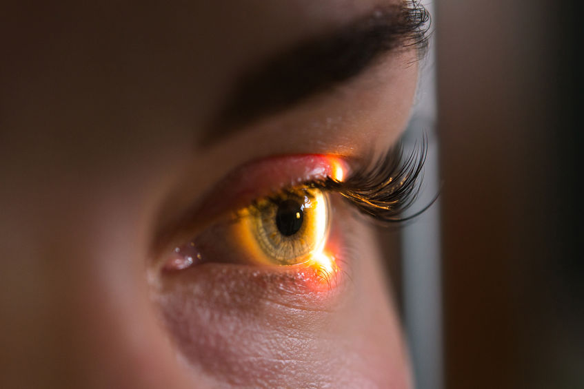 O que é o melanoma ocular?